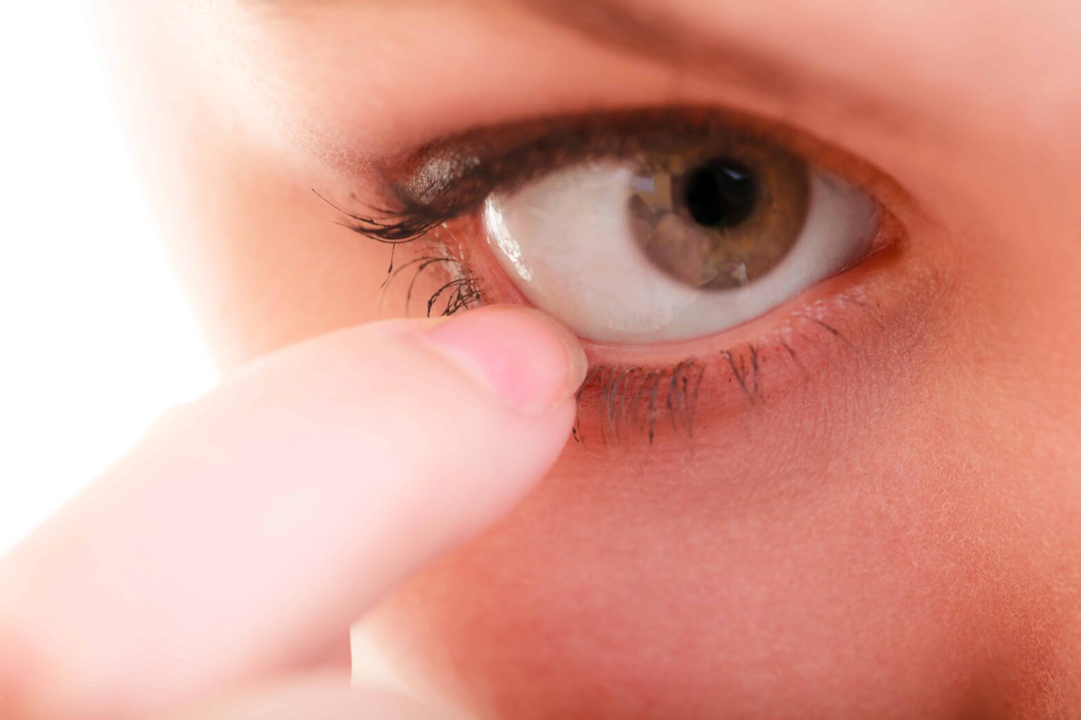 Facts about styes